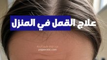 علاج القمل في المنزل